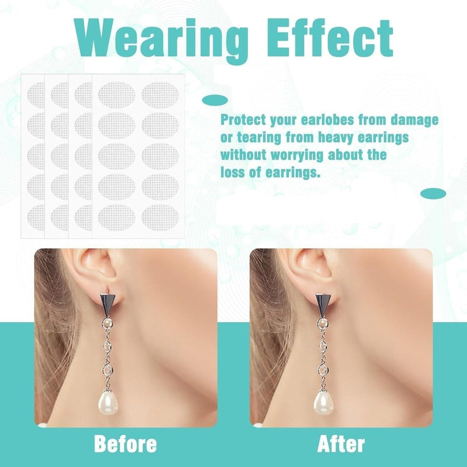 Premium Earlobe Support Patches (100 PCS) - Quik O Mart